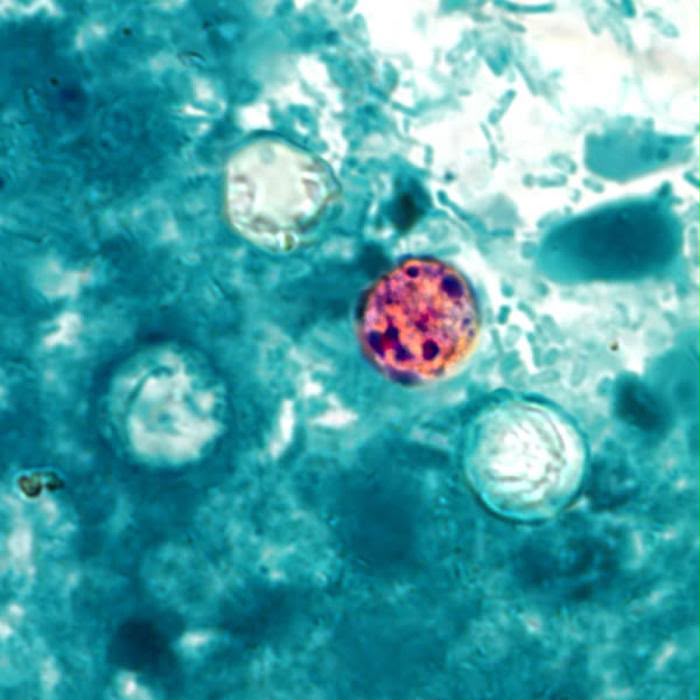 Recomendaciones ante la Ciclosporiasis