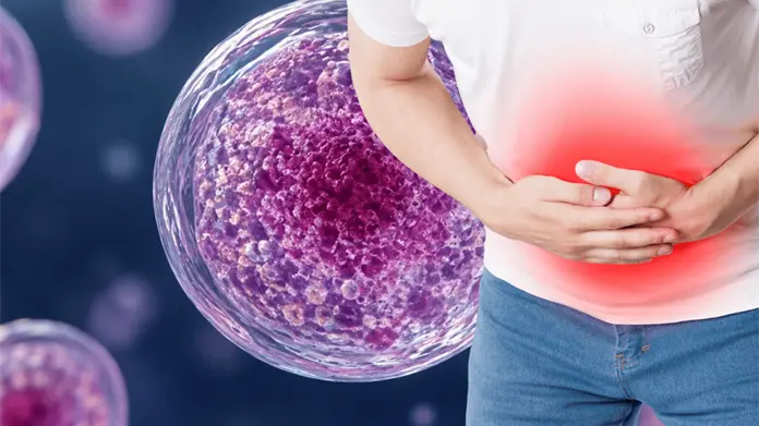 Confirman 33 casos de ciclosporiasis en México